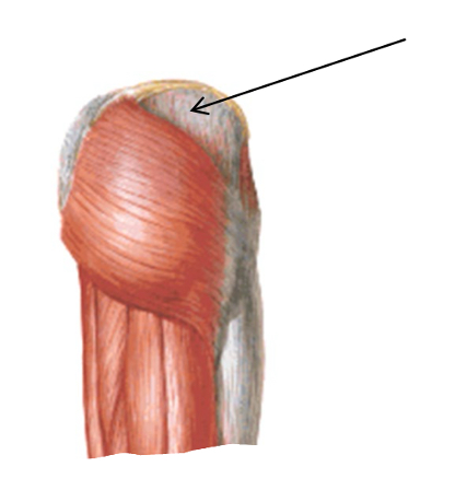 <p>What is the origin of this muscle?</p>