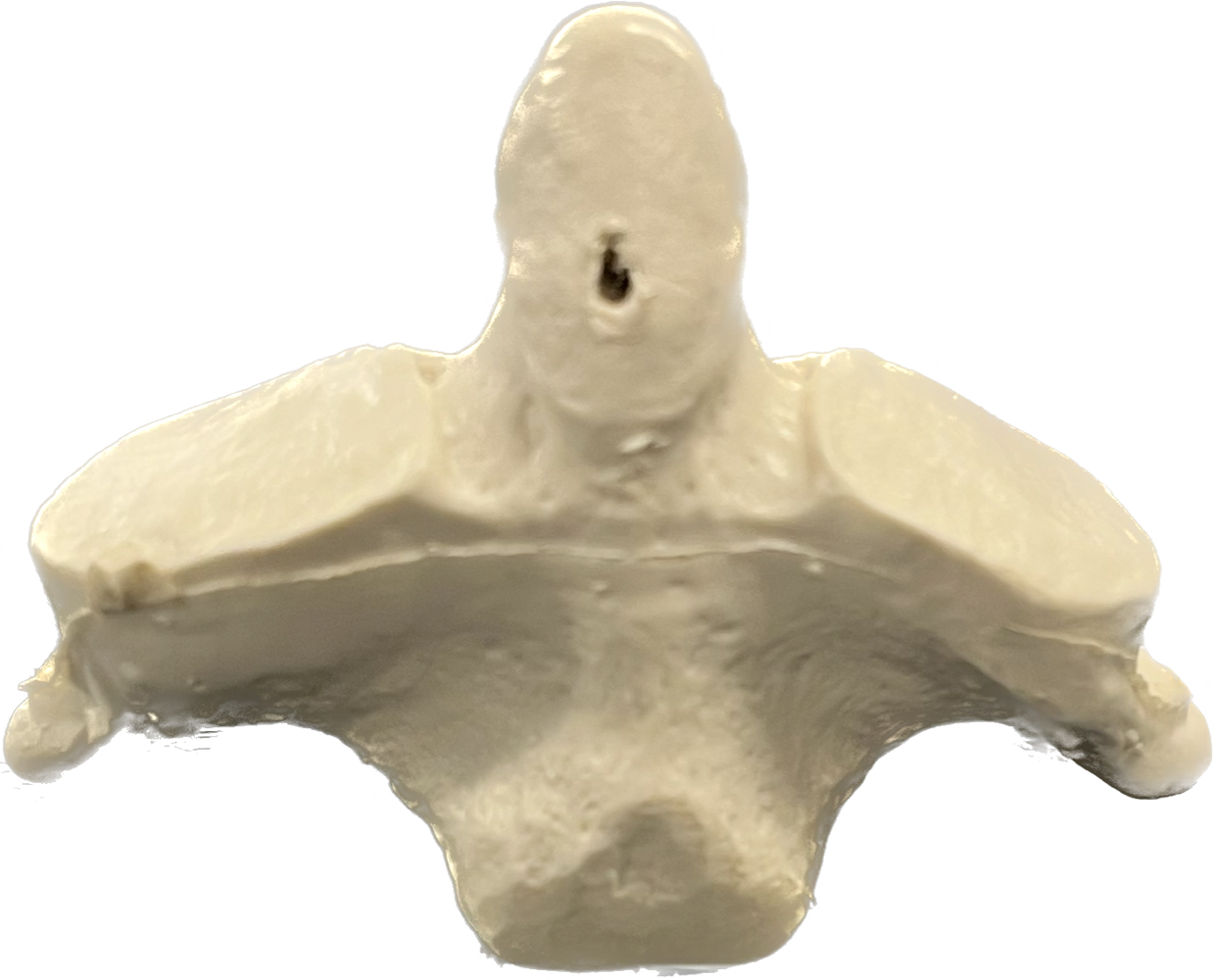 Which vertebrae is this?