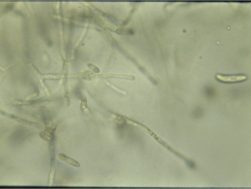 <ul><li><p>Crescent-shaped spores</p></li><li><p>y-branching</p></li><li><p>Cross walls</p></li></ul><p></p>