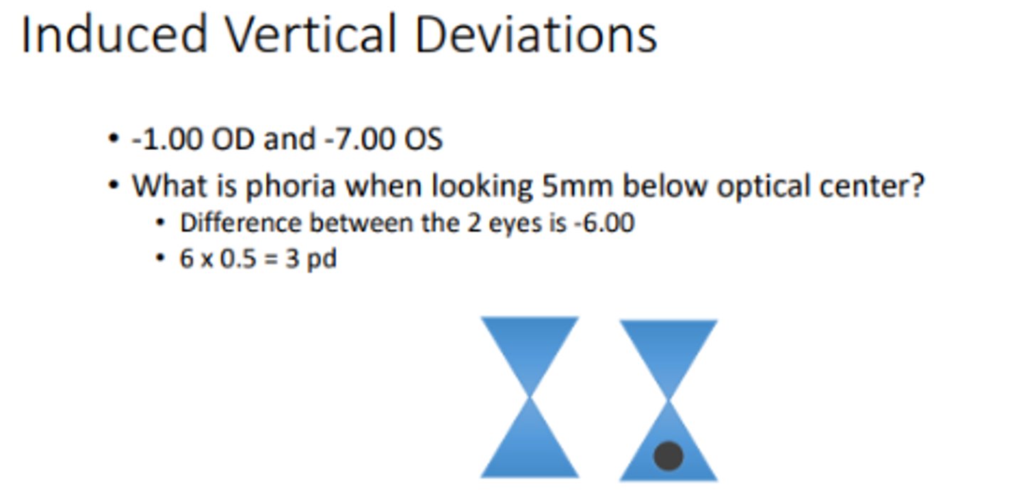 <p>_____ may occur when there is unequal refractive error between the two eyes and the eyes are pointed downward to read (not in primary gaze). In this case, testing phorias in downward gaze would be helpful to investigate symptoms while reading. I.e) plano OD, +6 OS will appear as a left hyper because it has to move down to track the image after being covered. The right eye will also move down due to yoked muscles, when uncovered it will appear as a hypophoria</p>