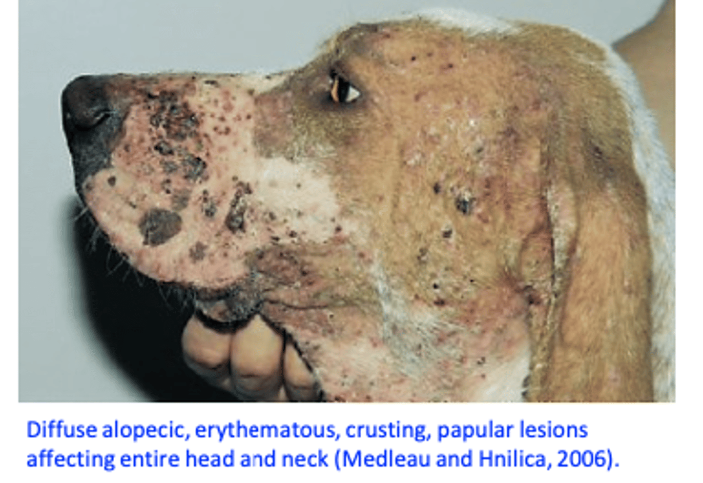 <p>• Onset in dogs older than 18-24 months of age that are immunocompromised because of an underlying condition such as:</p><p>Hyperadrenocorticism (endogenous or iatrogenic);</p><p>Hypothyroidism;</p><p>Immunosuppressive drug therapy;</p><p>Diabetes mellitus;</p><p>Neoplasms;</p><p>Stress: oestrus, pregnancy, surgery;</p><p>Adult-onset generalized demodicosis is not inherited.</p>