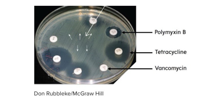 <p>In this image of a Kirby-Bauer Test, the zone of inhibition is greatest for the antibiotic _____</p>