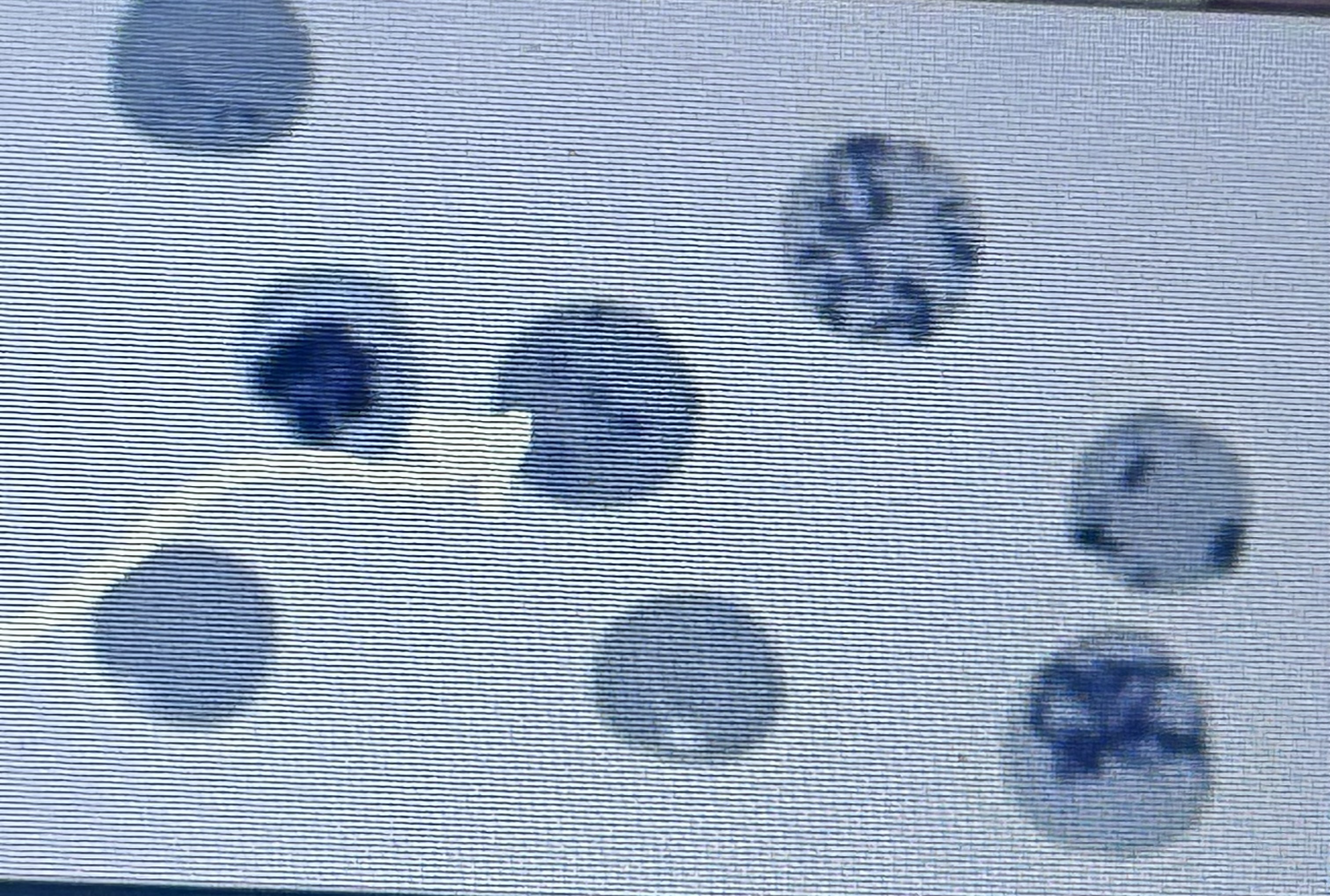 <p>With basophilic stepping</p>