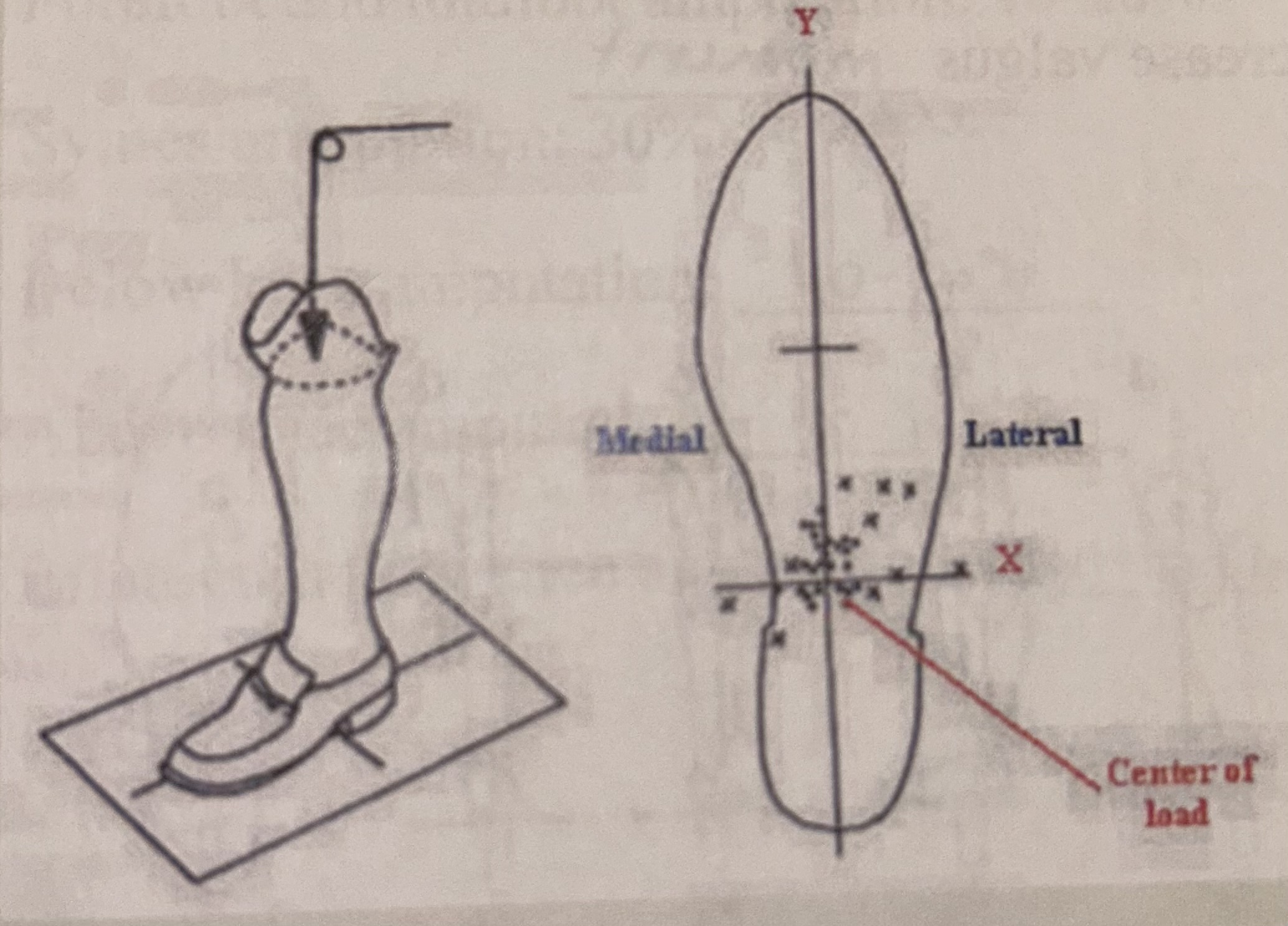 <ul><li><p>COL of the body should project on the posterior 1/3 on Y axis, and medial 1/3 on X axis</p></li></ul><p></p>