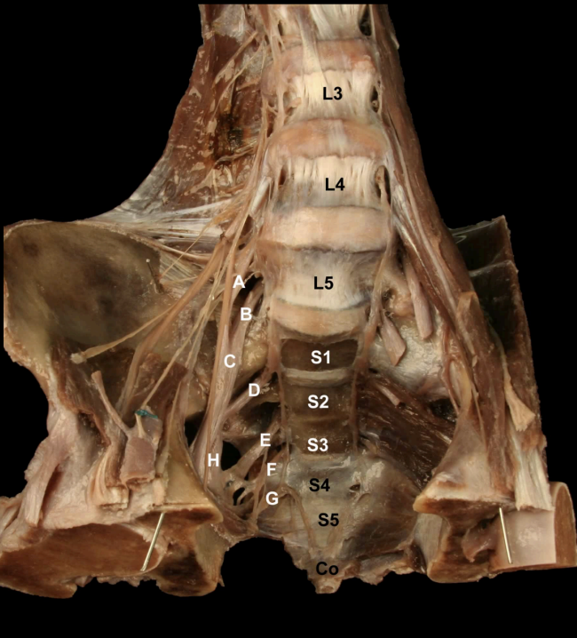 <p><strong>&nbsp;</strong></p><p>Identify the Nerves and their corresponding nerve levels indicated on this <strong>Anterior view</strong> of the Pelvis:<strong> Sacral Plexus</strong></p>