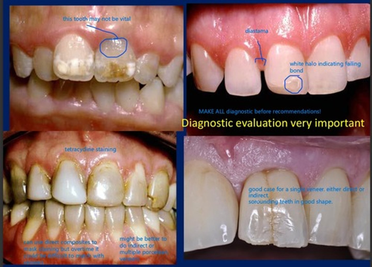 <p>make all diagnostics.</p><p>Some examples from lecture:</p><p>are the teeth viable?</p><p>are teeth overcrowded?</p><p>is there need for bleaching?</p><p>is there need for endodonic treatment?</p><p>are the diastemas?</p>