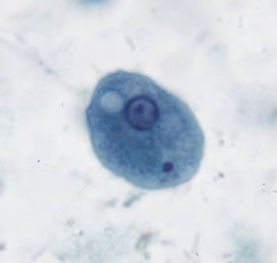 <p>ingested bacteria</p>