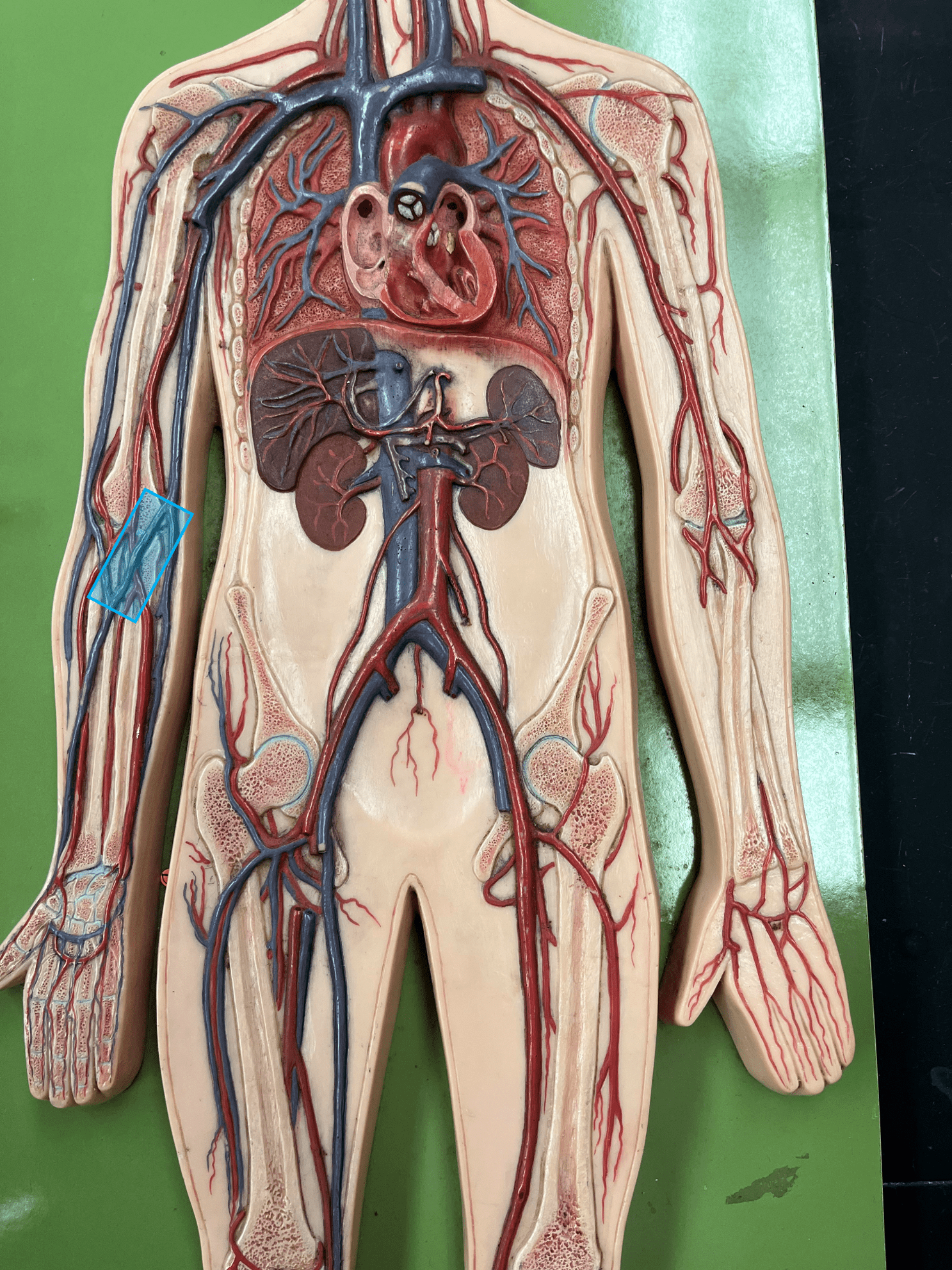<p>• A vein of the upper limb.</p>
<p>• Drains the forearm.</p>
<p>• Connects the basilic and cephalic veins at the antecubital (anterior part of elbow).</p>