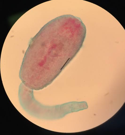 <p><em>Fasciola hepatica</em> cercaria</p>