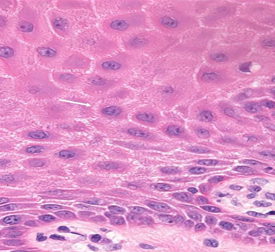 <p>squamous cells </p>