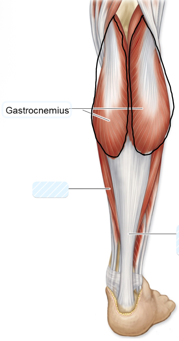 <p>gastrocnemius</p>