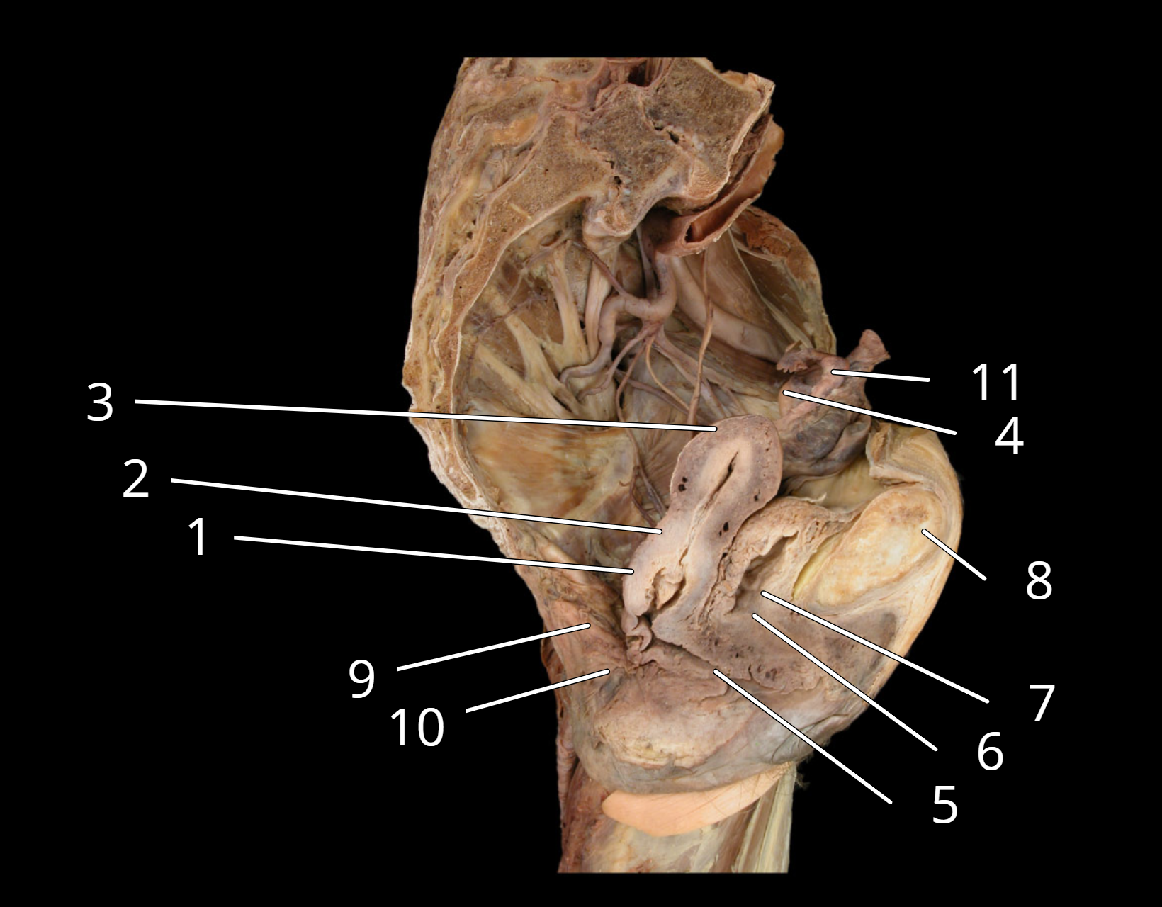 <p>Female reproductive structures, sagittal view </p>