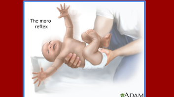 <p>Moro/Startle</p>