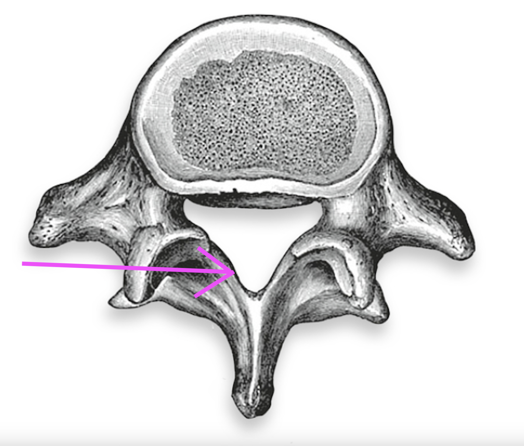 <p>What part of the vertebrae is this?</p>