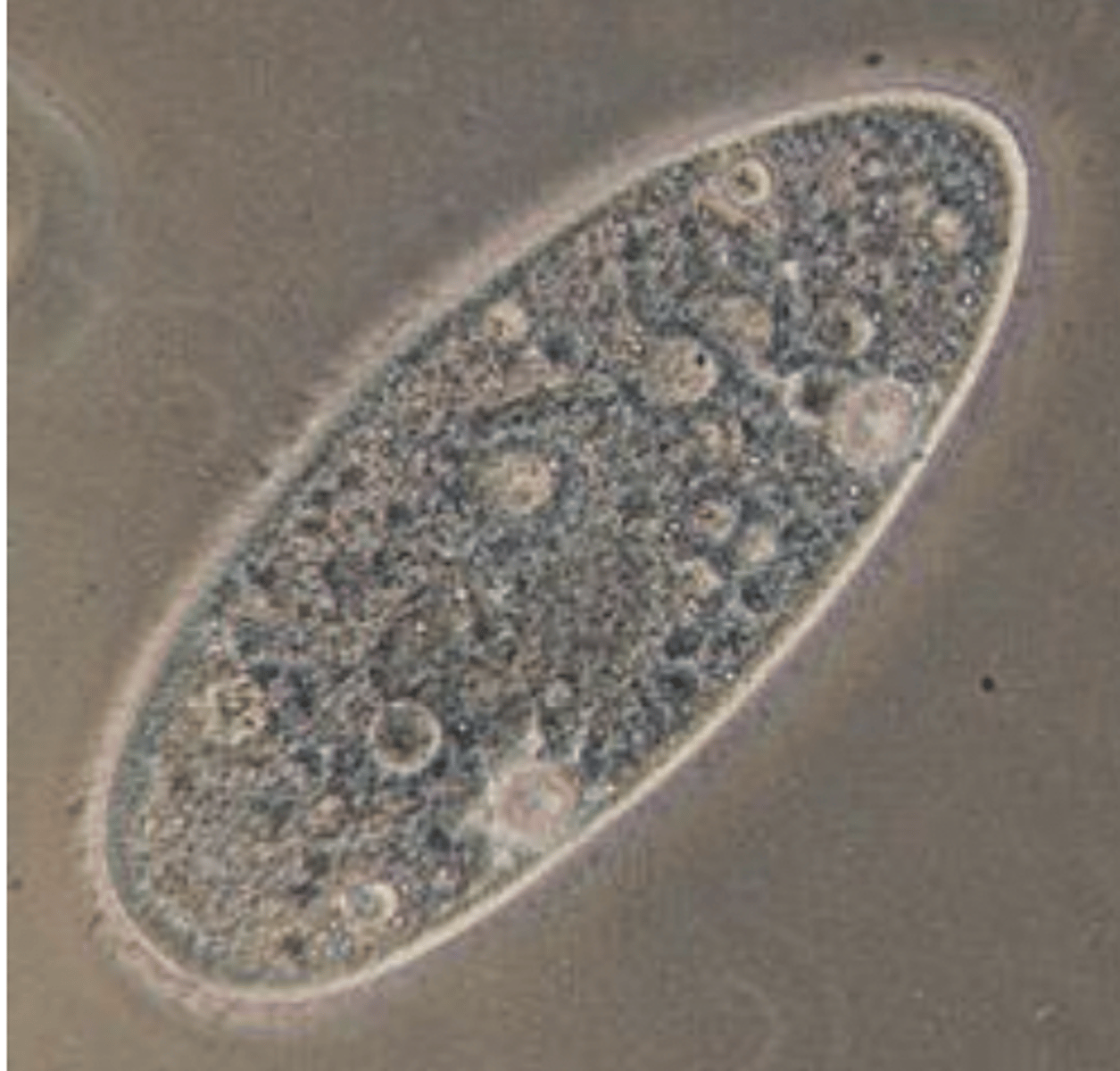 <p>protozoa</p>