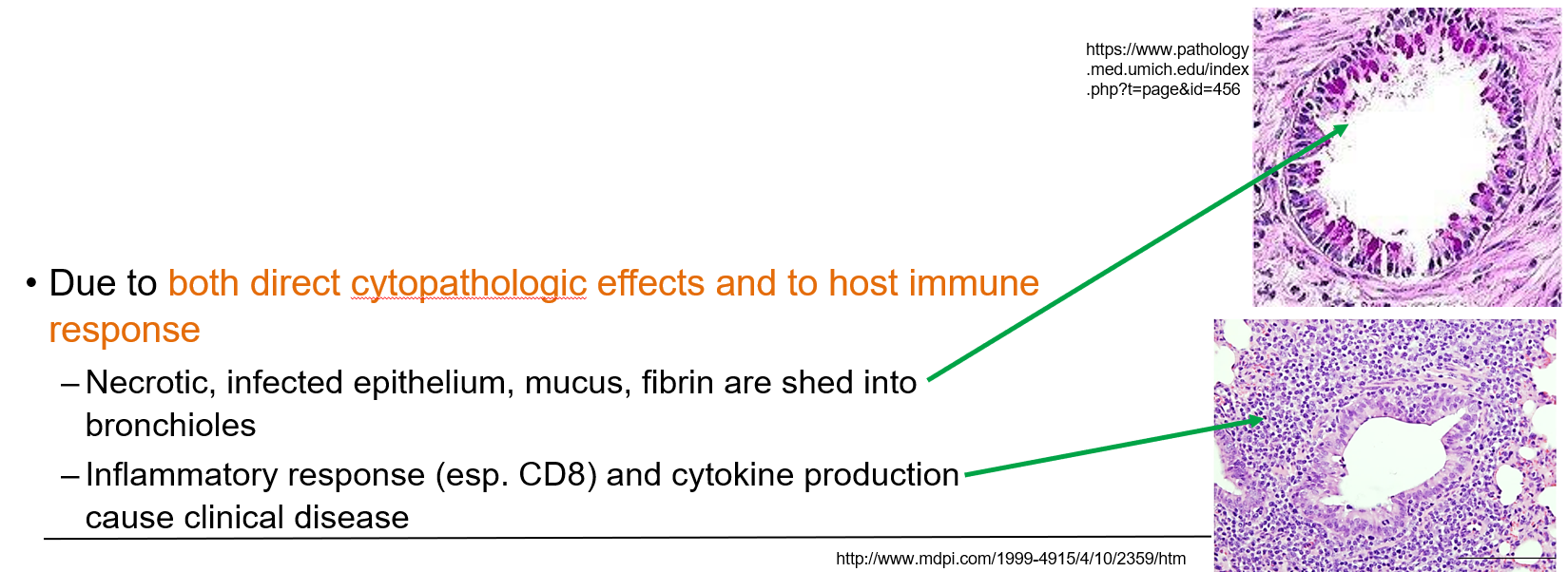 <p>Both direct <strong>cytopathic effects</strong> (epithelial cell death, mucus, fibrin) and the <strong>host immune response</strong> (CD8+ T cells, cytokines) lead to airway damage and disease.</p>