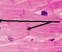 <p>attachment sites between the transverse lines between cardiac muscle cells (CARDIAC ONLY)</p>