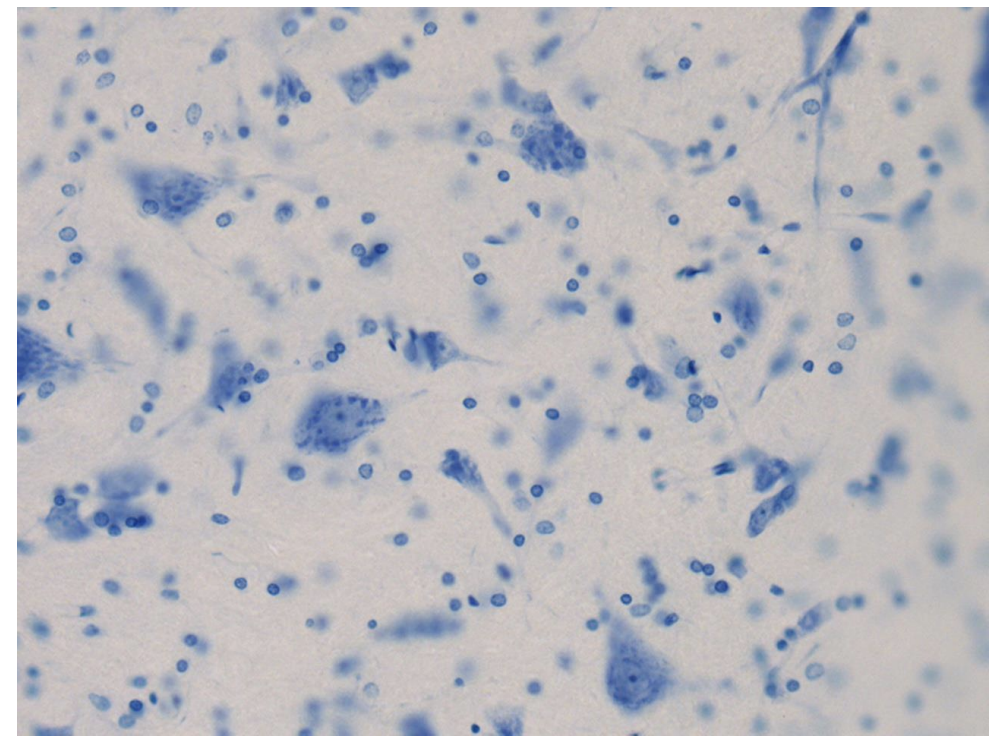 <p>koks čia dažymo būdas?</p>