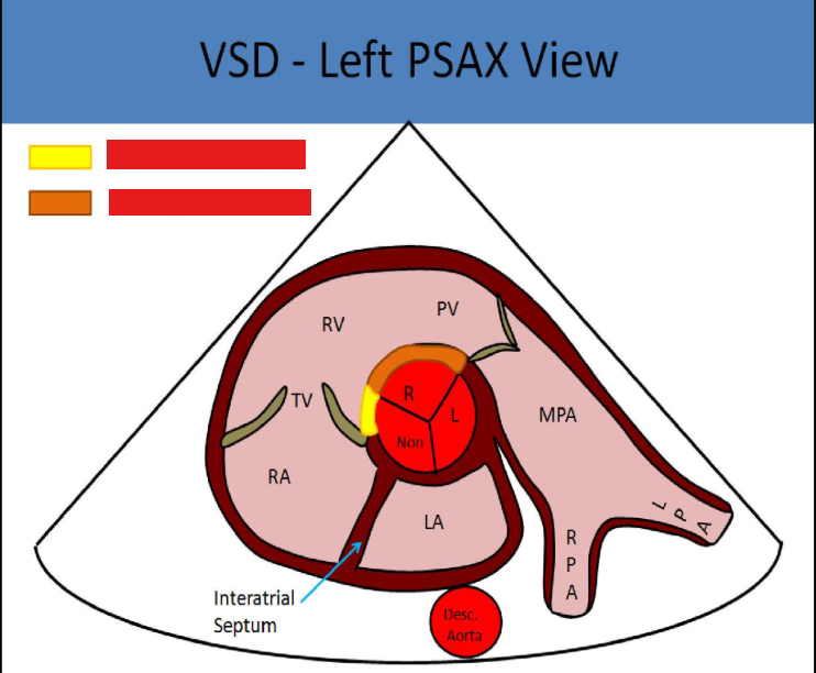 <p>what vsds are pictured</p>