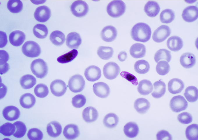 <p>What is this? What disease does it cause? What super group is it in?</p>