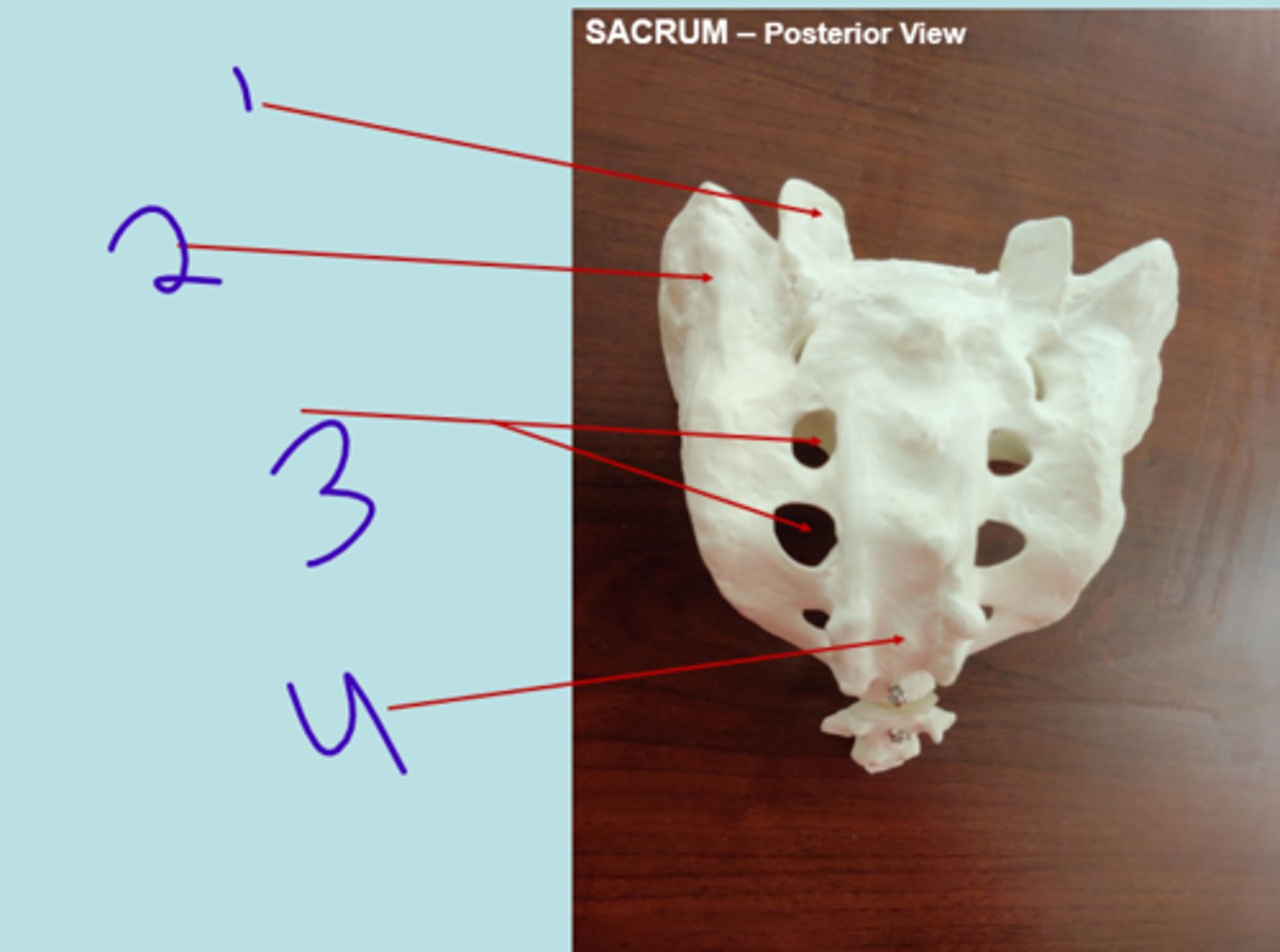 <p>sacrum posterior - #3</p>
