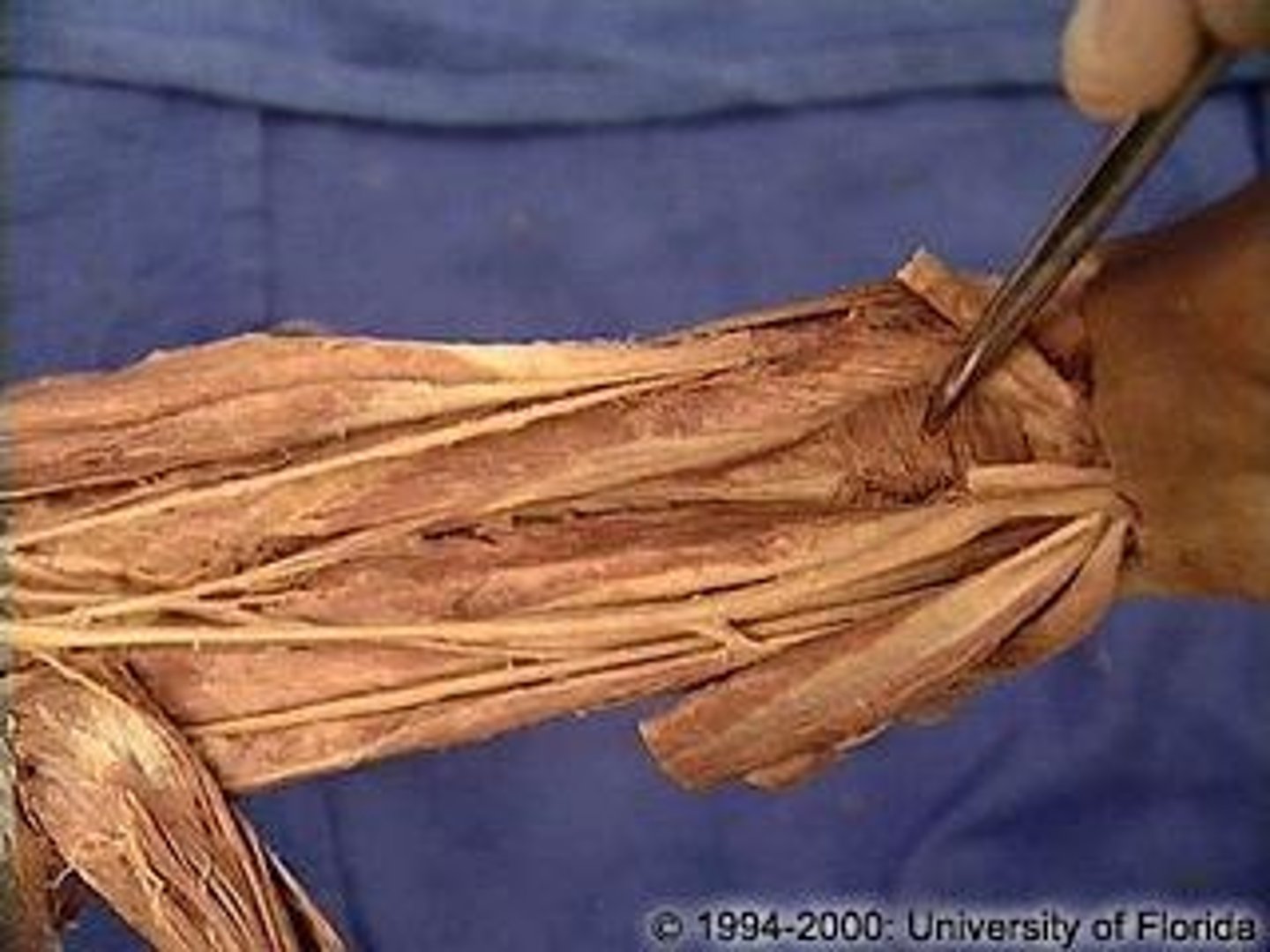 <p>What muscle is this?</p><p>Attachments?</p><p>Action?</p><p>Nerve?</p>