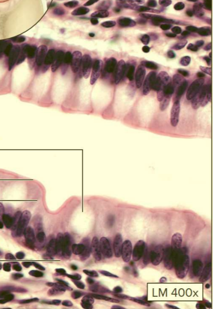 <p>What type of tissue?</p>