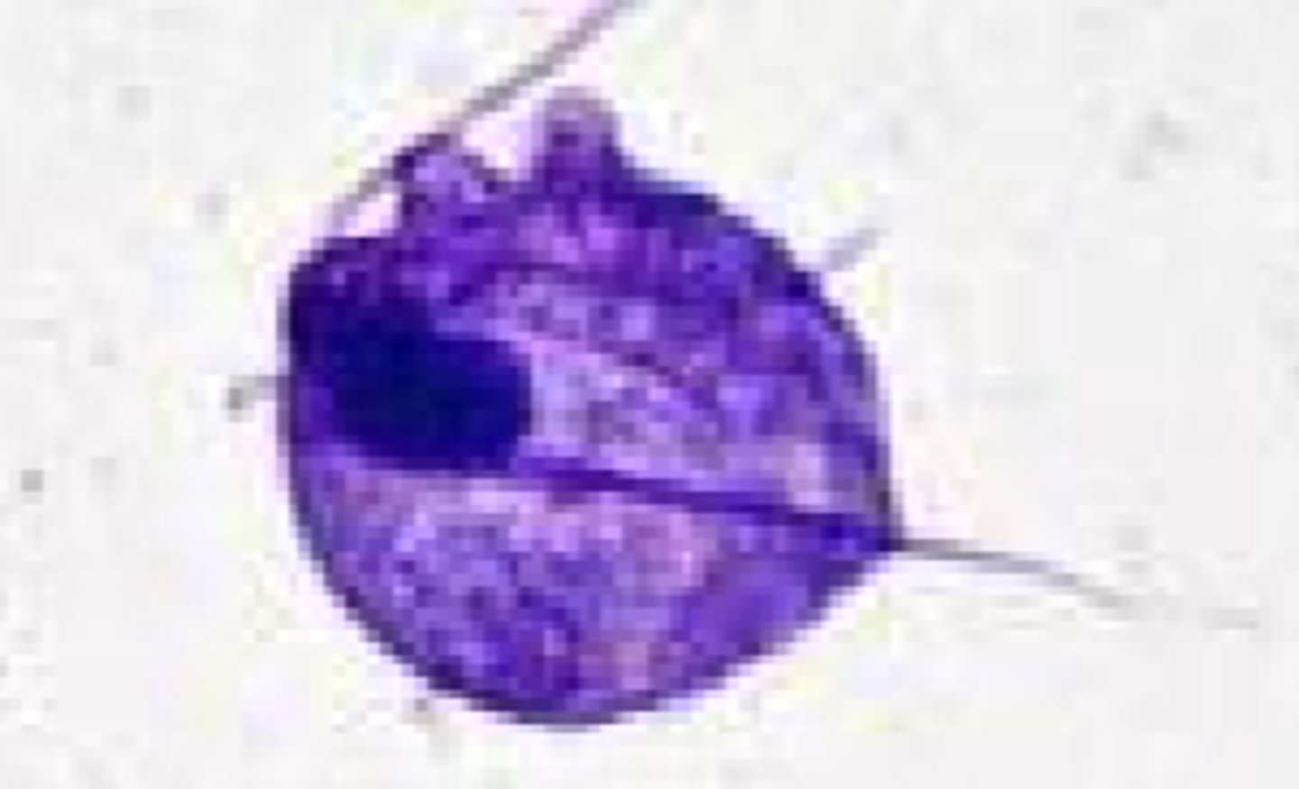 <p>Cats</p><p>Large Intestine</p>