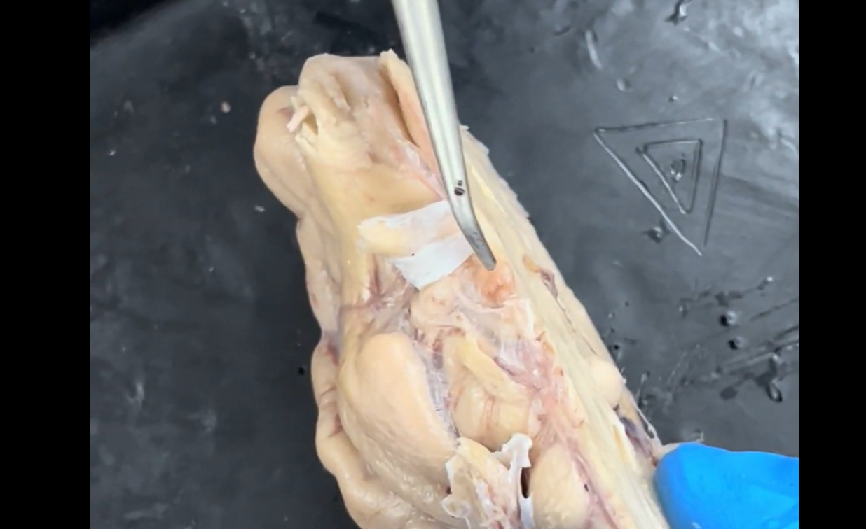 <p>Name the structure the probe is pointing to.</p>
