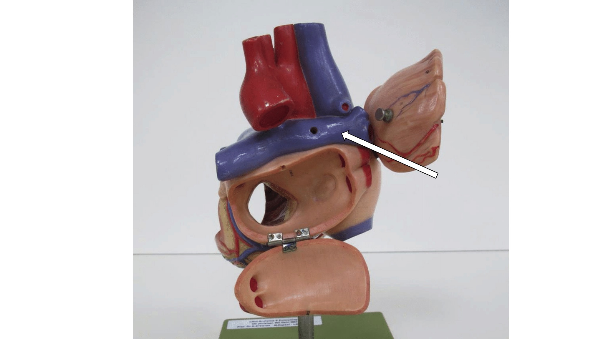 <p>dorsaal zicht</p>