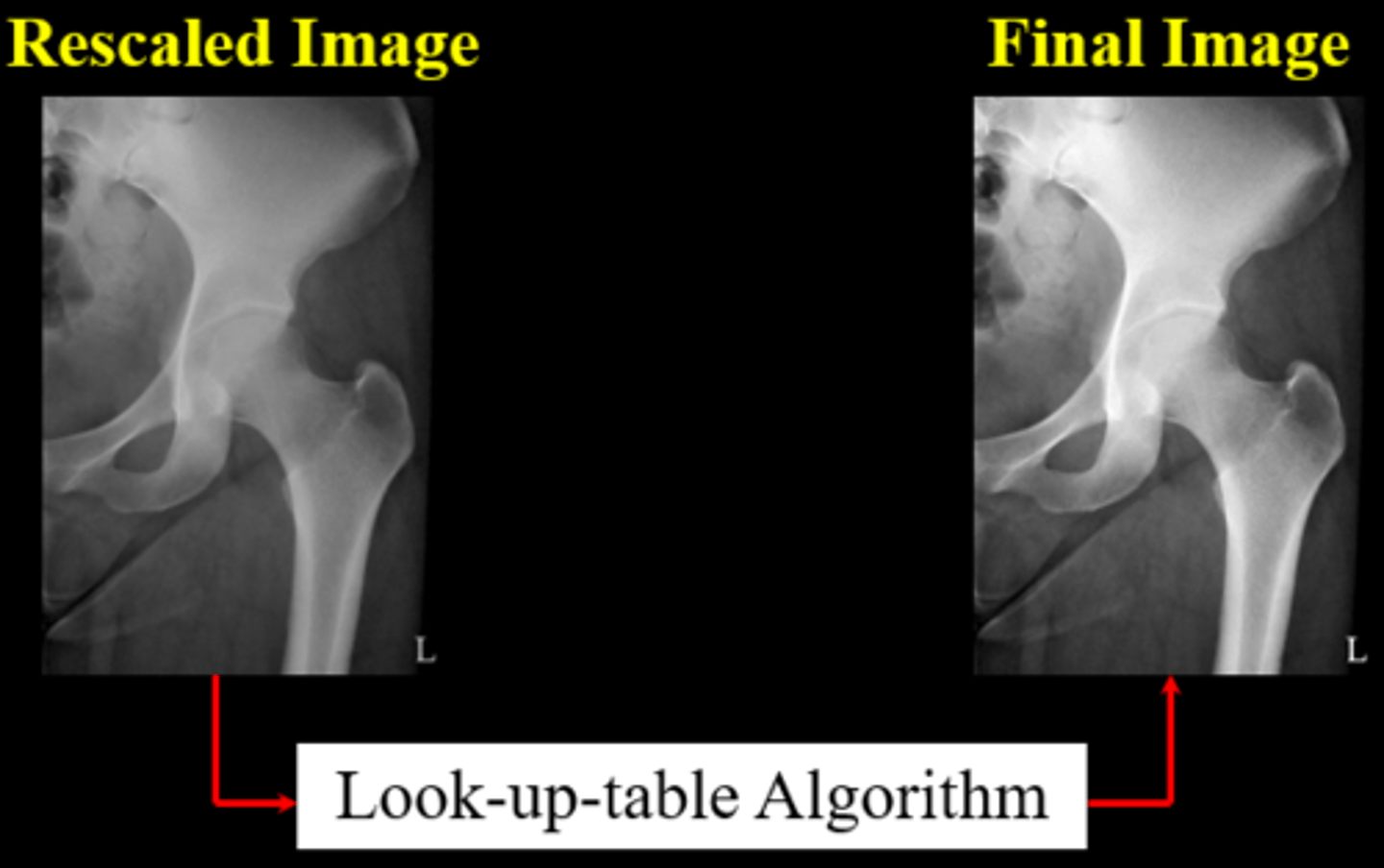 <p>A digital processing technique that is used to modify an overexposed or underexposed image</p>