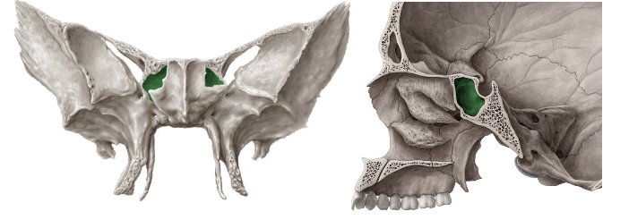 <p>Cavidad neumática<br>inferior y anterior a la silla turca</p>