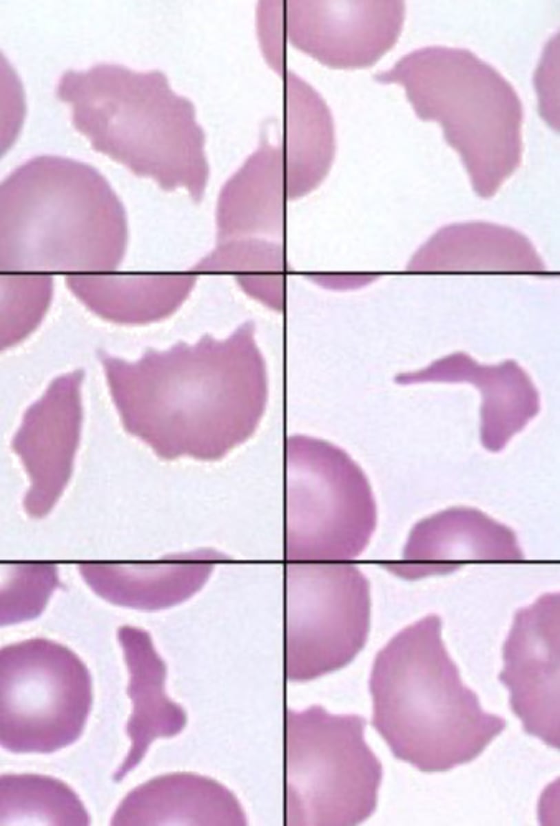 <p>What are these ?</p>
