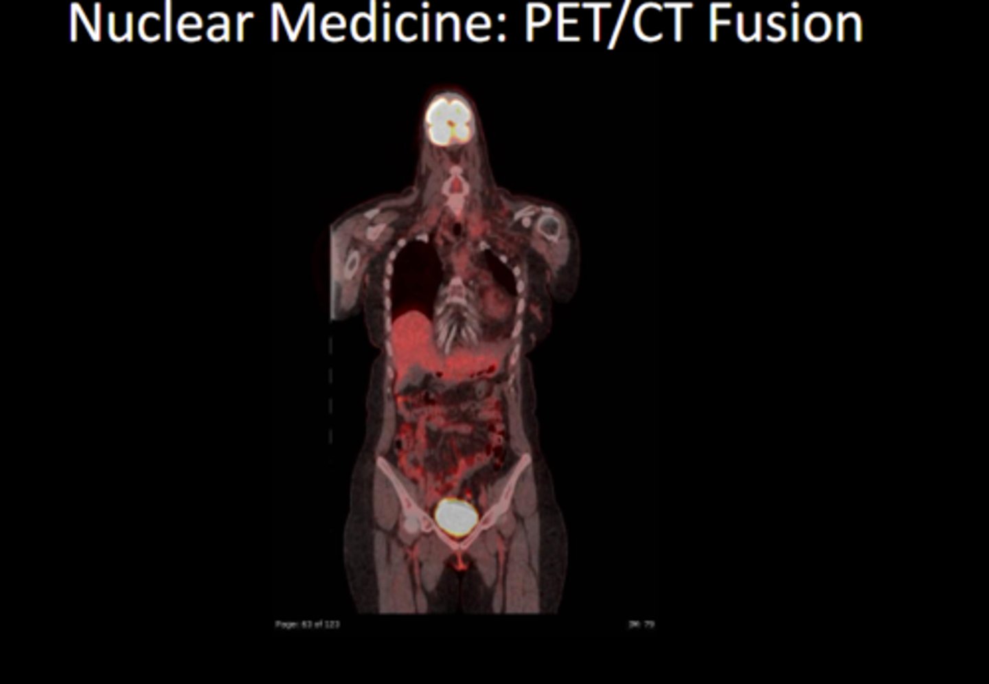 <p>fusion shows imaging for anatomy and radiopharmaceutic</p>