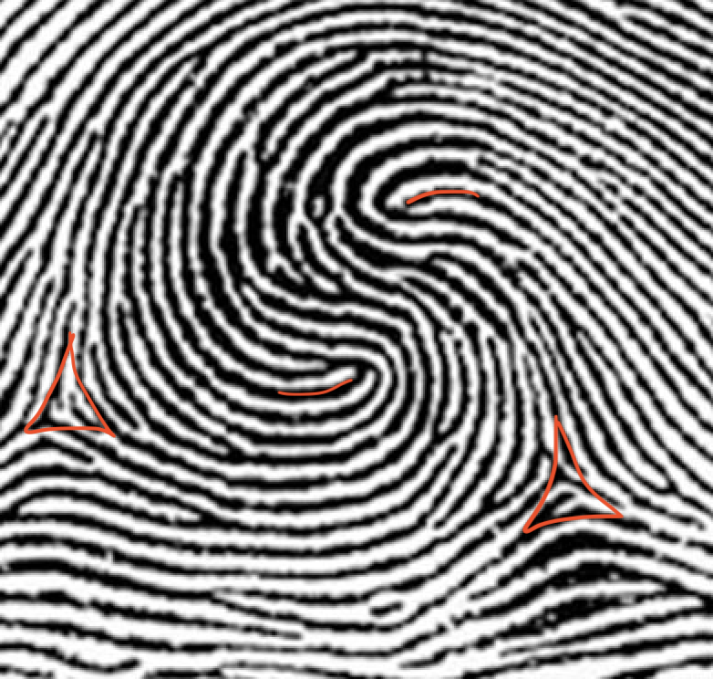 <p>double loop whorl, two deltas, two cores</p>