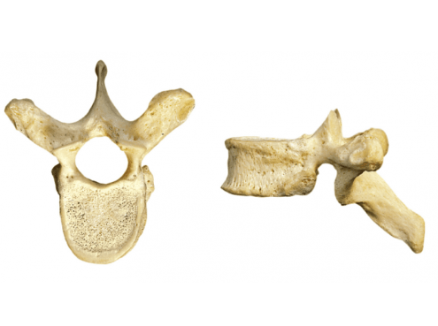 <p>What kind of vertebrae is this?</p>