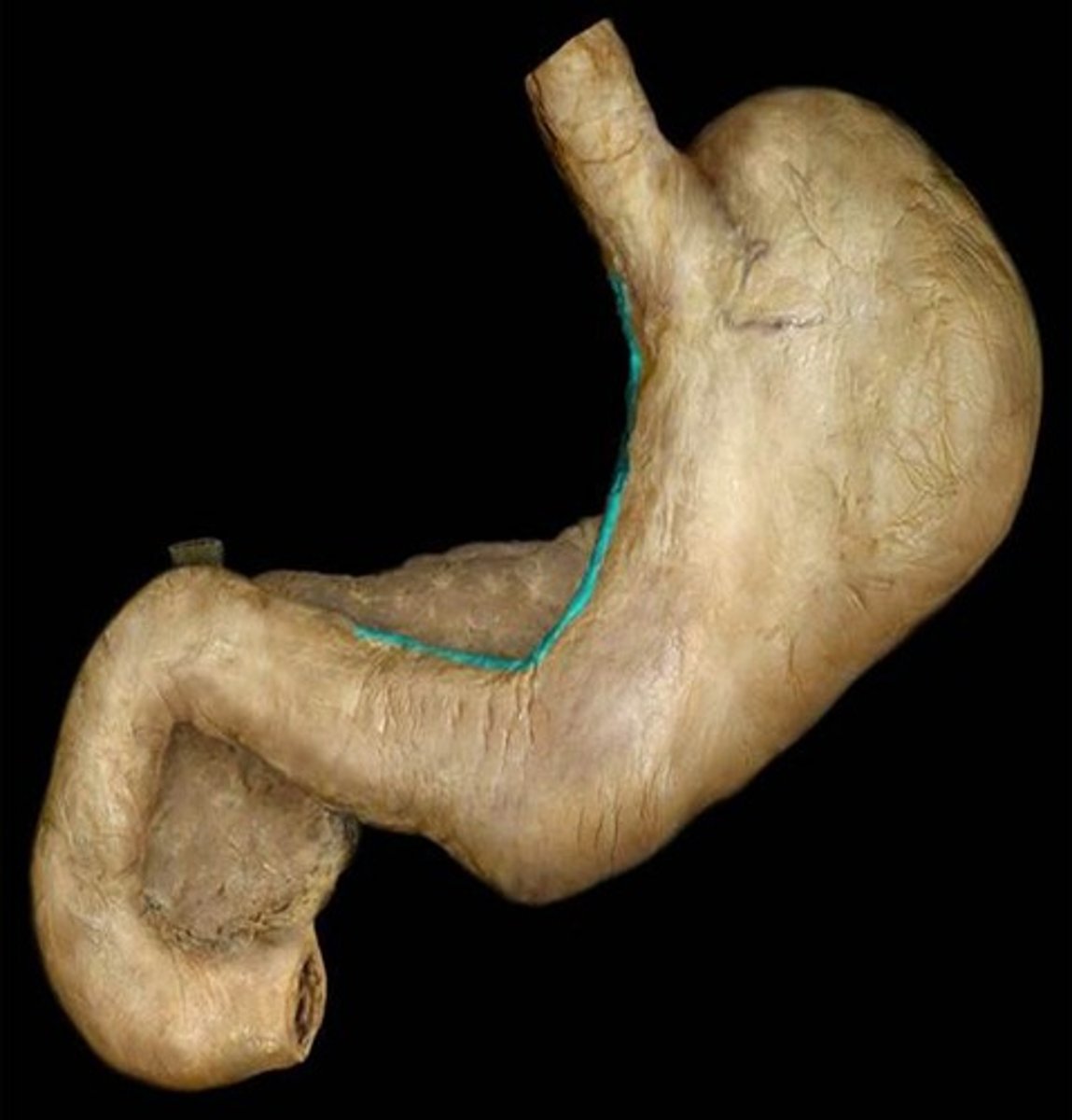 <p>Name this part of the stomach.</p>