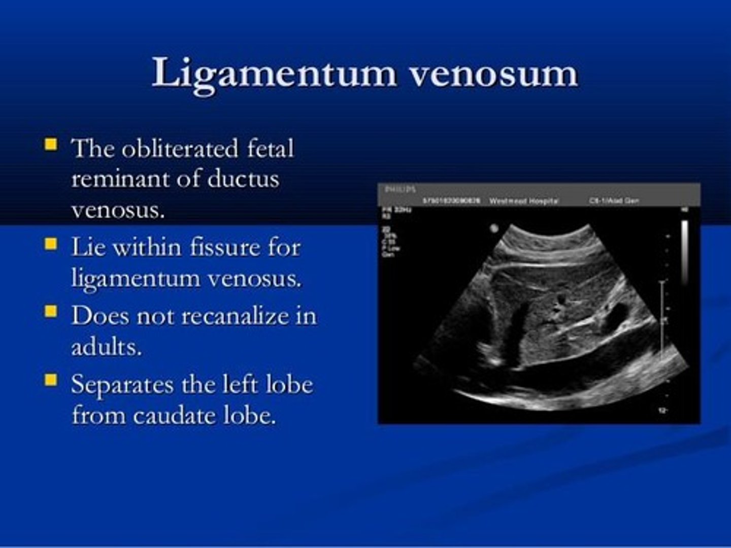 <p>It separates the left lobe from the caudate lobe and is a remnant of the ductus venosus.</p>