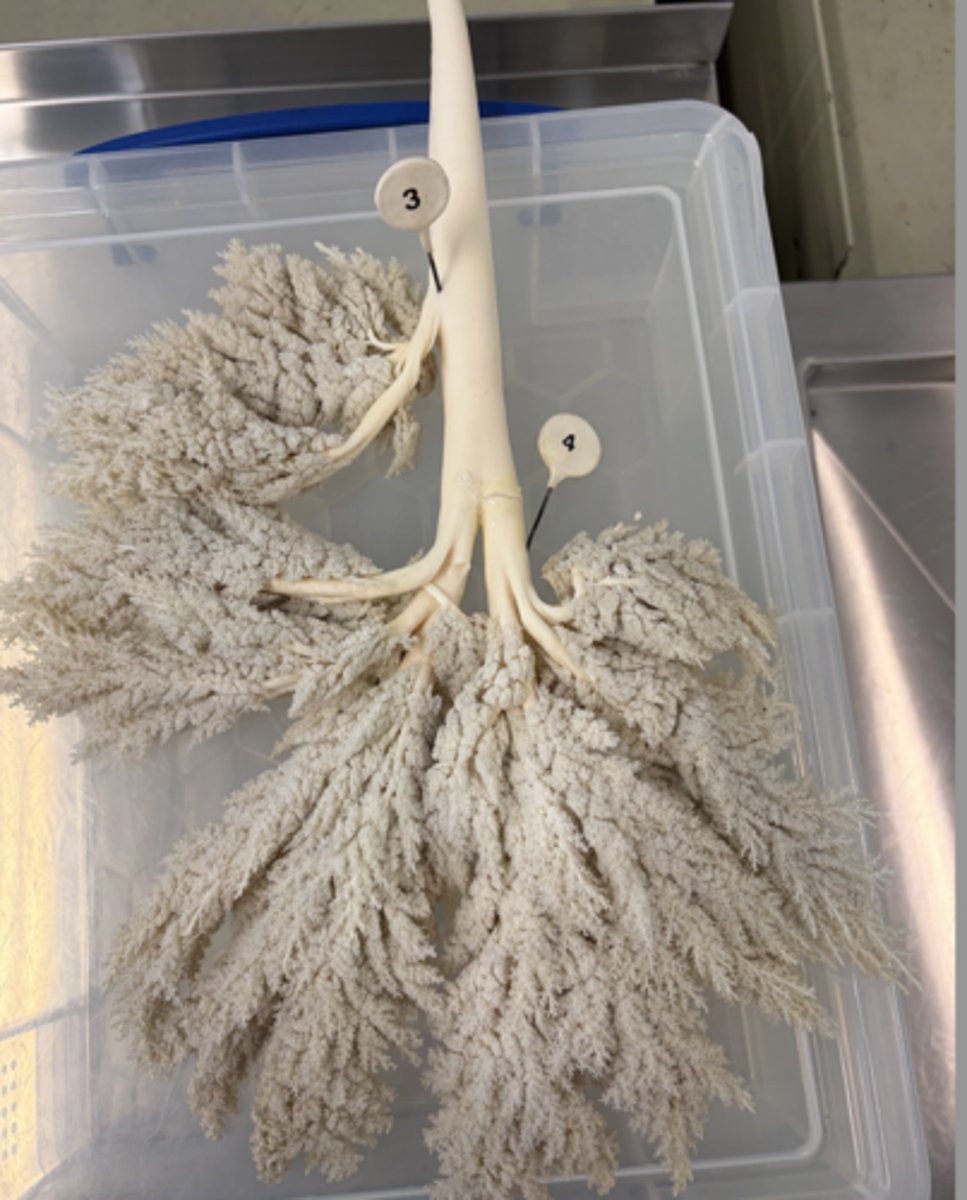 <p>a. Which lymph node is typically found here?</p><p>b. What lymphocenter does this lymph node belong to?</p>