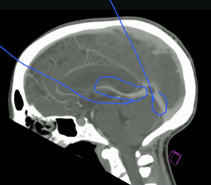 <p>What veins are these</p>