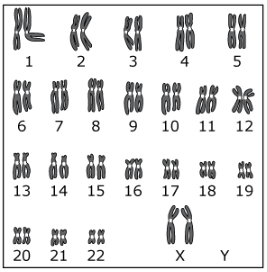 The karyotype diagram shows the *(diploid/haploid)* number of chromosomes that would be found in *(gametes/body cells)* of a human female.