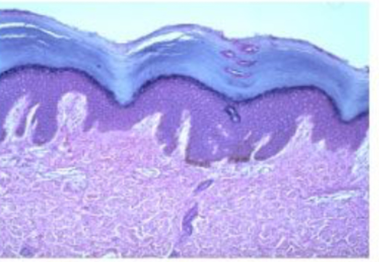<p>stratified squamous: keratinized</p>