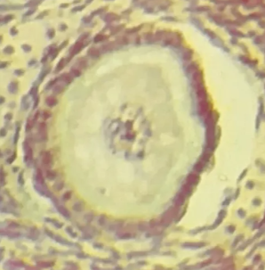 <p>How many layer/s of follicle cells are present in this picture?</p>