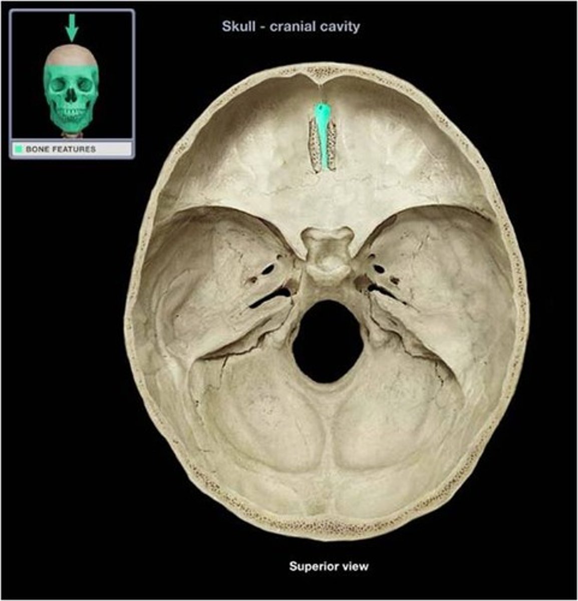 <p>superior projection in the middle of the cribriform plate of the ethmoid bone; providing a point of attachment for the dura mater, helping to secure the brain within the skull</p>