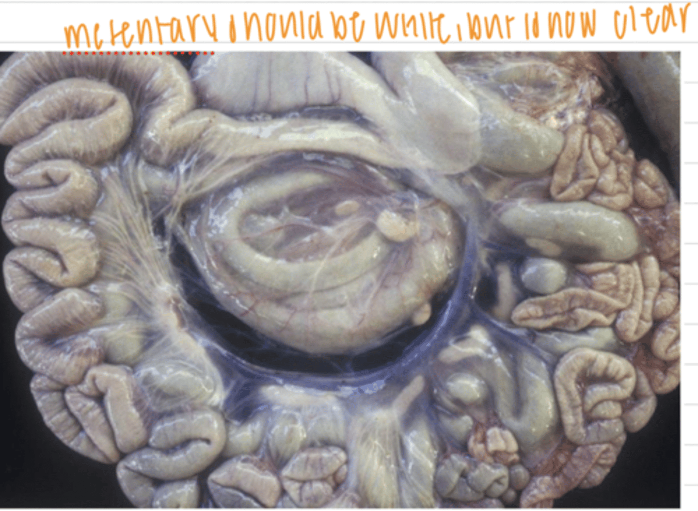 <p>grossly:</p><p>less fat, replaced by a clear, yellowish, jelly material</p><p>microscopically:</p><p>smaller adipocytes</p>