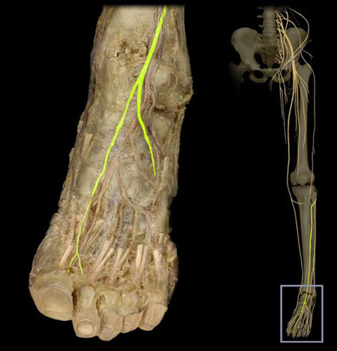 <p>-lower extremity (knee, crus, ankle)</p>