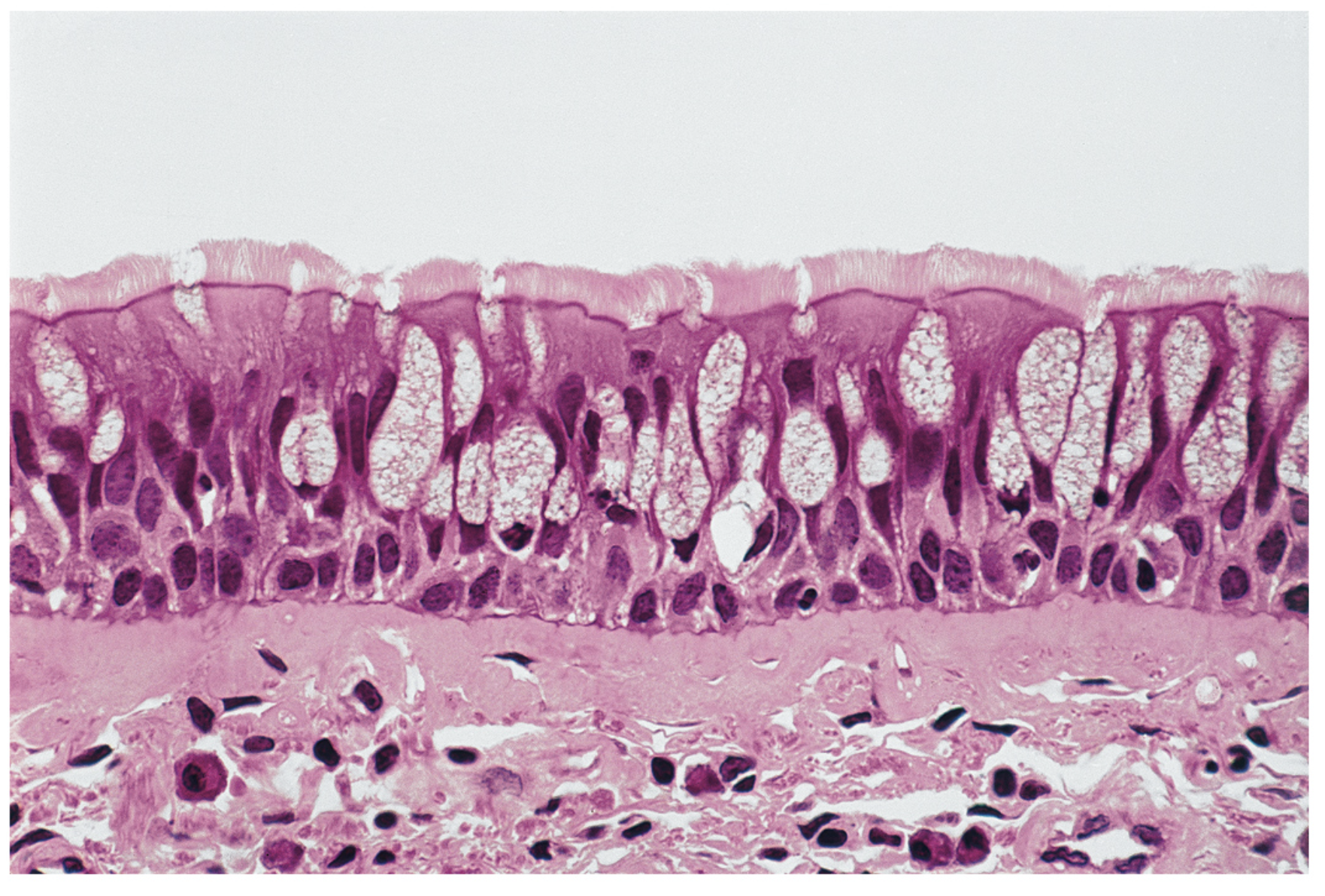 <p>Pseudostratified ciliated columnar epithelium.</p>