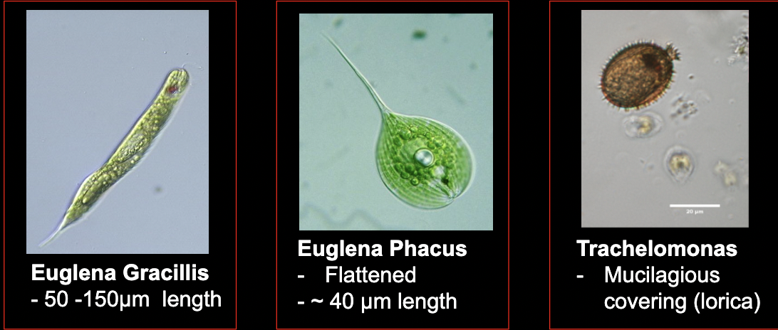 <p>What bacteria is this?</p>