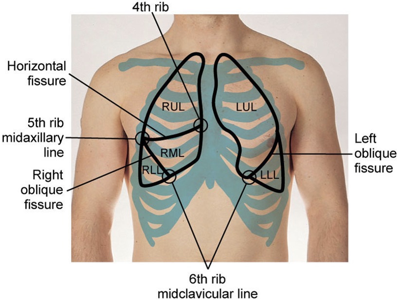 <p>Right lung larger than left and has 2 fissures.</p>
