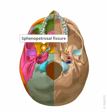<p>-narrow gap situated between the greater wing of sphenoid bone and the petrous portion of the temporal bone.</p><p>-skull base landmark </p>